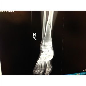 Meet your Posher, Grace